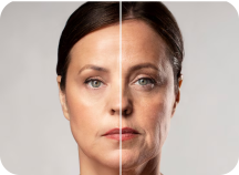 Antiaging Treatment